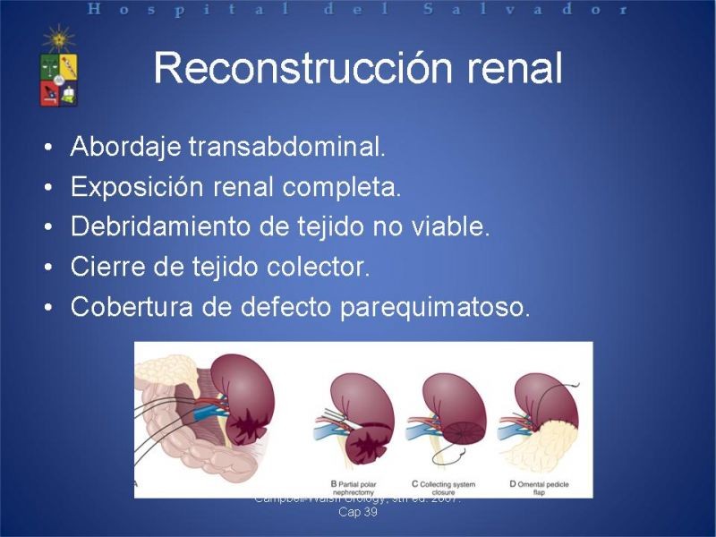 Diapositiva 16 de Trauma Renal