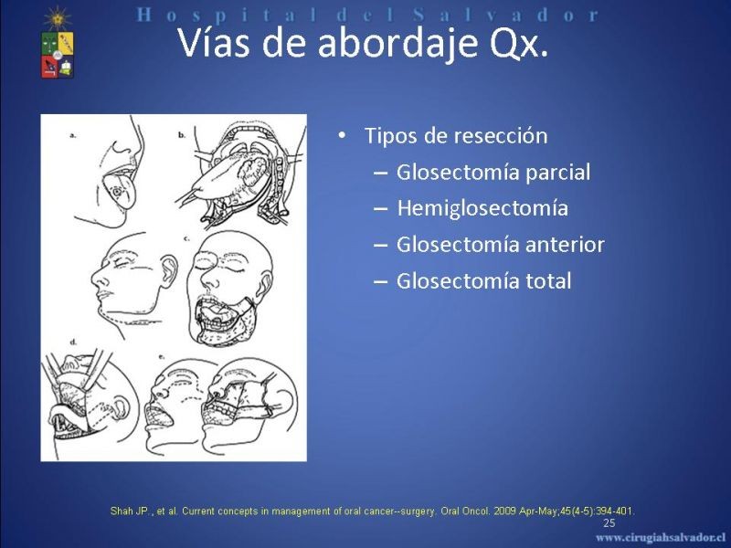Diapositiva 24 de Cáncer de Lengua