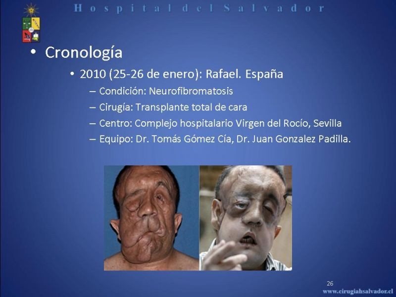 Diapositiva 25 de Transplante Facial
