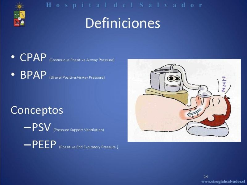 Diapositiva 13 de Ventilación Mecánica no Invasiva