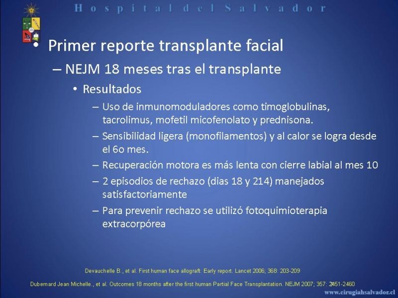 Diapositiva 6 de Transplante Facial