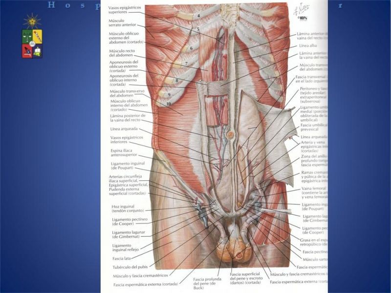 Diapositiva 8 de Técnica quirúrgica: Stoppa
