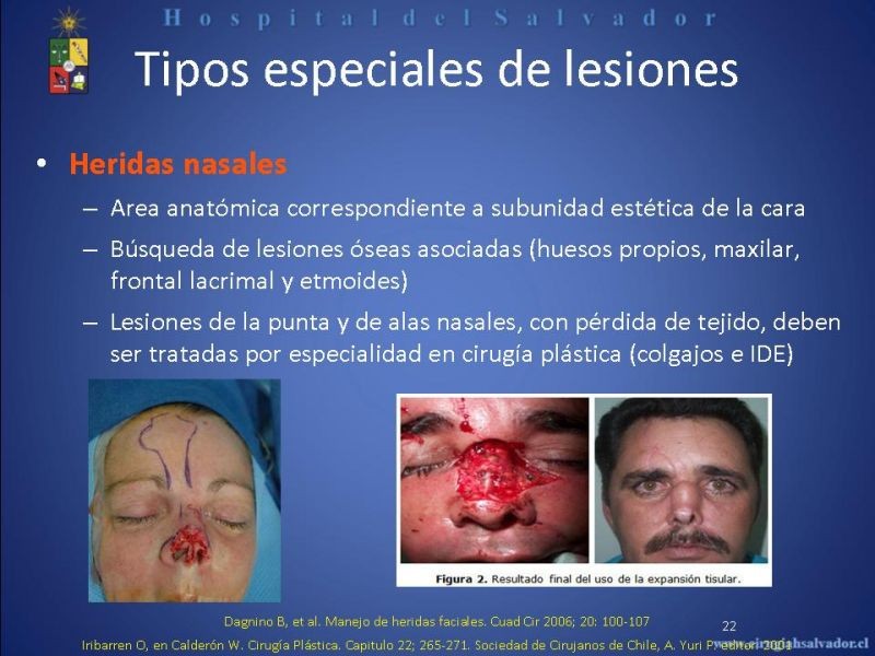 Diapositiva 21 de Evaluación y manejo de lesiones faciales