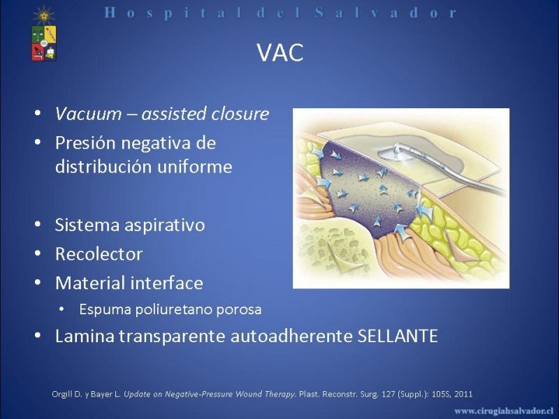Diapositiva 2 de VAC e injertos dérmicos