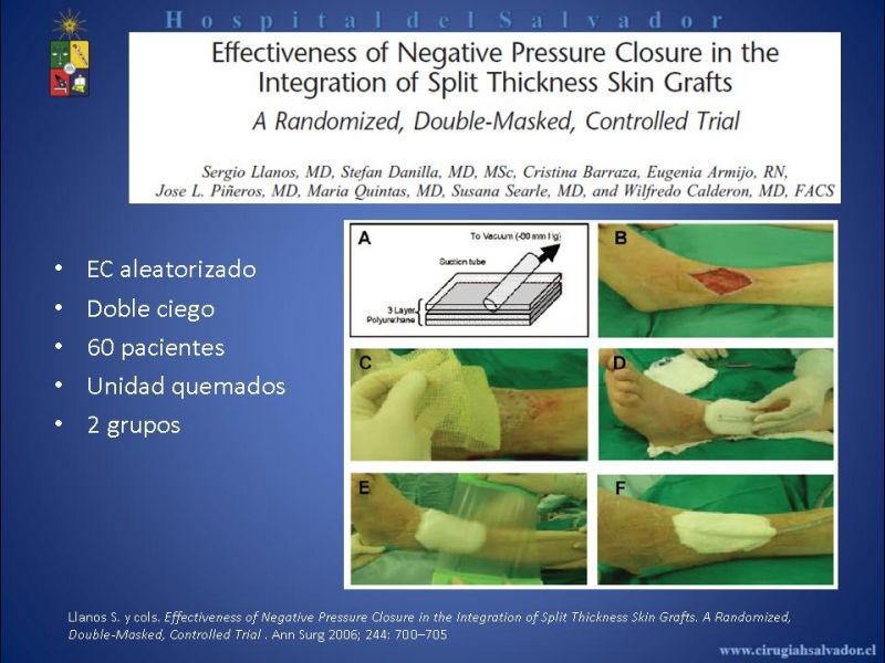 Diapositiva 15 de VAC e injertos dérmicos