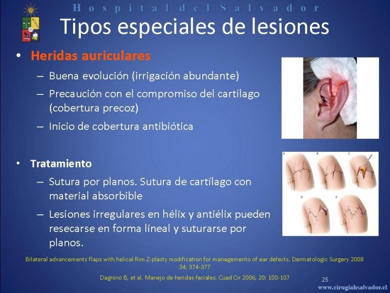 Diapositiva 24 de Evaluación y manejo de lesiones faciales