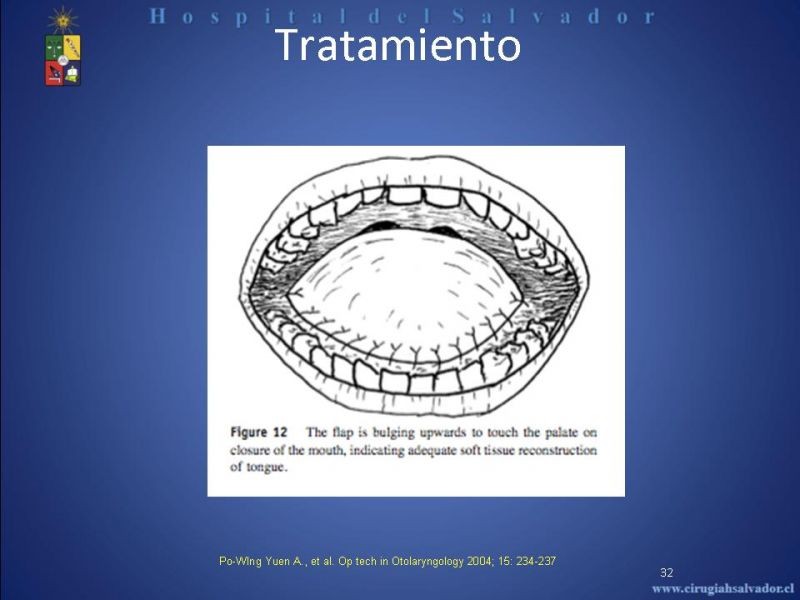 Diapositiva 31 de Cáncer de Lengua