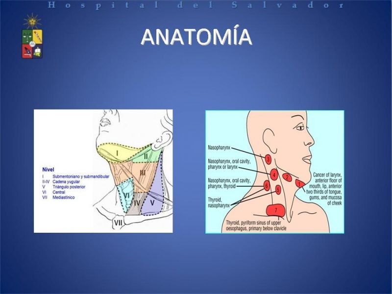 Diapositiva 4 de Biopsia de Ganglio Centinela en Cáncer de Cabeza y Cuello