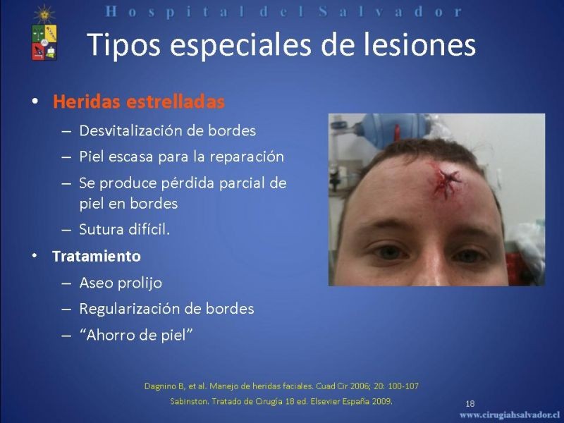 Diapositiva 17 de Evaluación y manejo de lesiones faciales