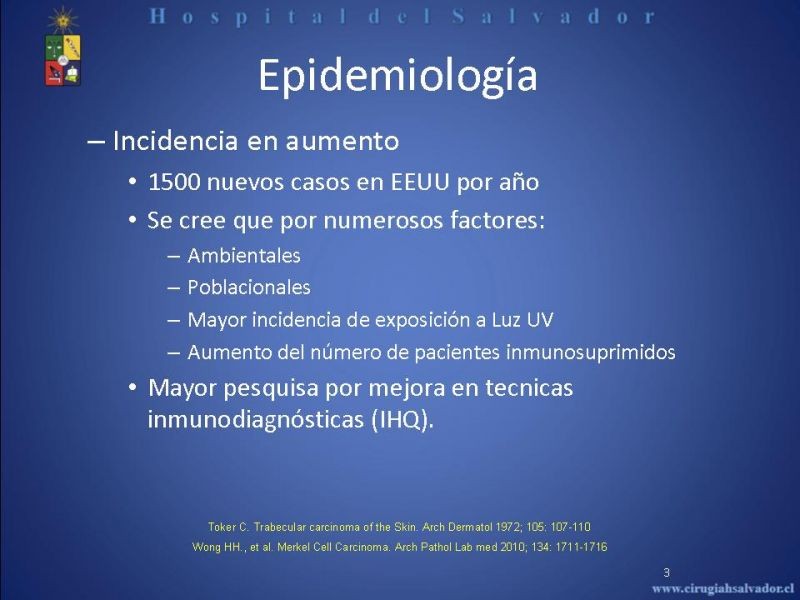 Diapositiva 2 de Carcinoma de Células de Merkel