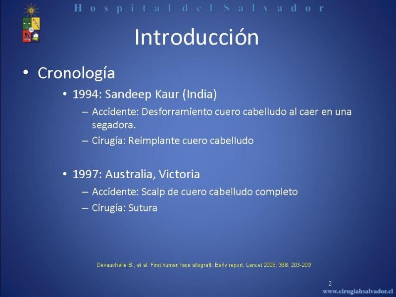 Diapositiva 1 de Transplante Facial