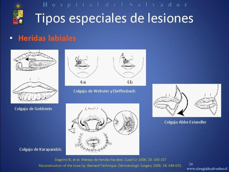 Diapositiva 23 de Evaluación y manejo de lesiones faciales