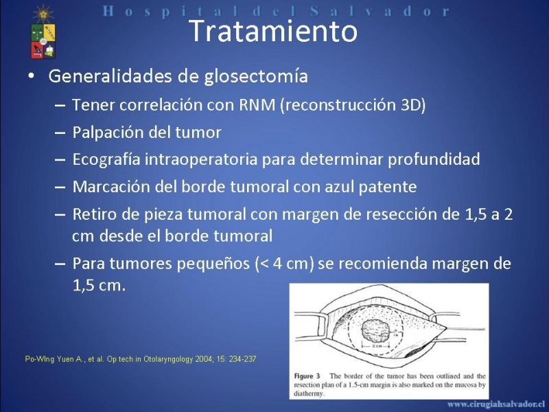 Diapositiva 25 de Cáncer de Lengua