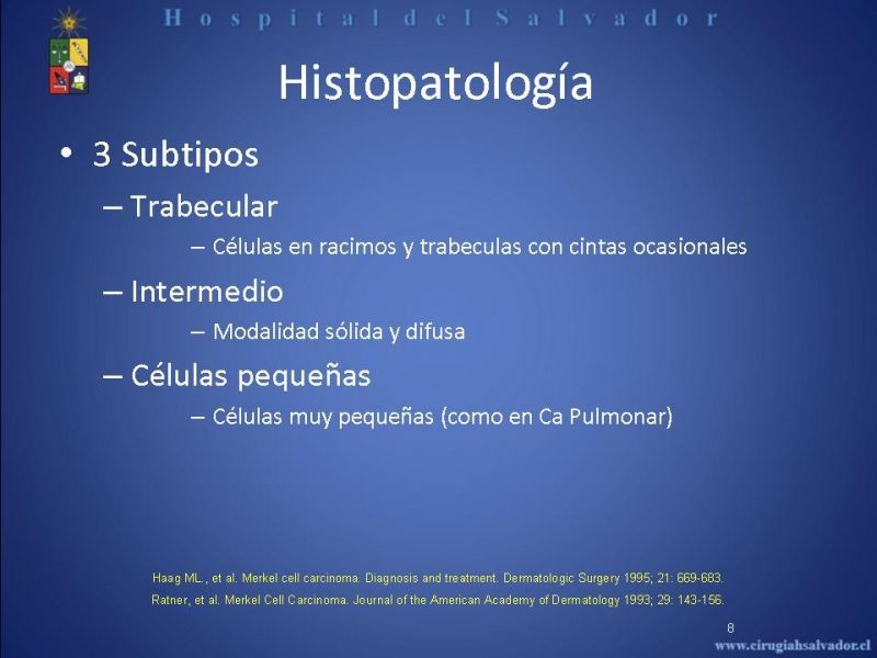 Diapositiva 7 de Carcinoma de Células de Merkel