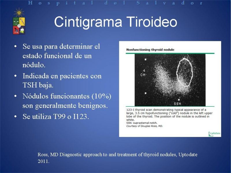 Diapositiva 7 de Enfrentamiento del Nódulo Tiroideo 