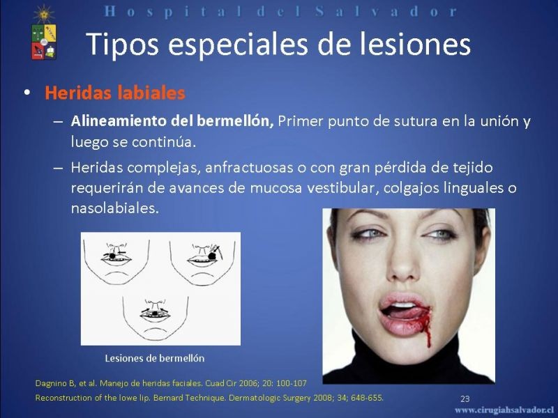 Diapositiva 22 de Evaluación y manejo de lesiones faciales