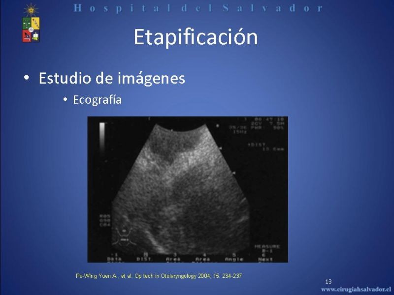 Diapositiva 12 de Cáncer de Lengua