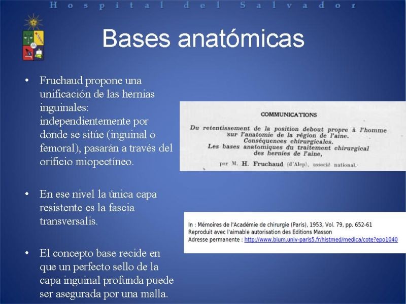 Diapositiva 2 de Técnica quirúrgica: Stoppa