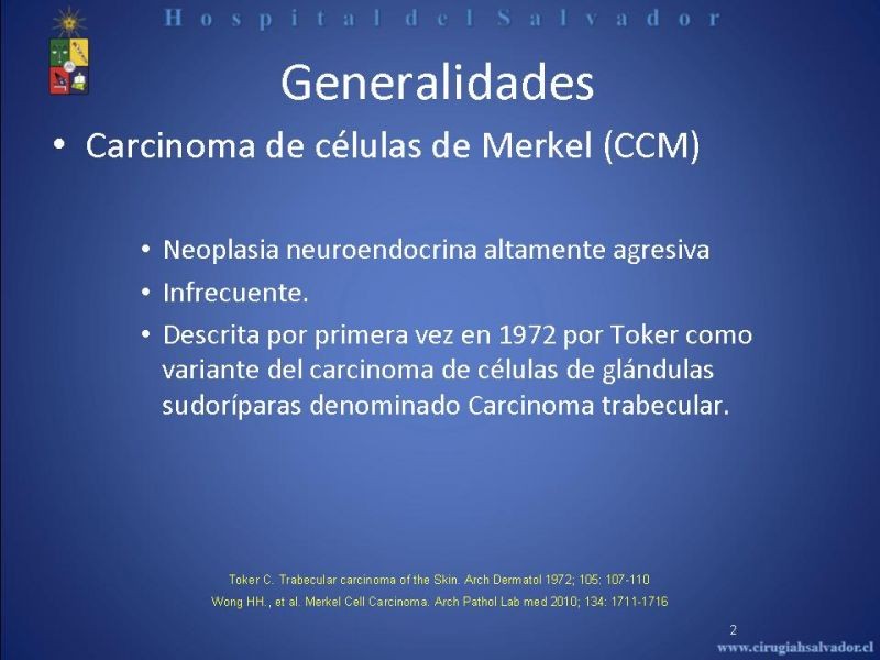 Diapositiva 1 de Carcinoma de Células de Merkel