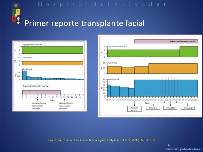 Diapositiva 5 de Transplante Facial