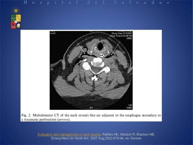 Diapositiva 8 de Lesiones Cervicales Traumáticas