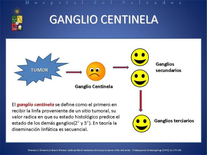 Diapositiva 5 de Biopsia de Ganglio Centinela en Cáncer de Cabeza y Cuello