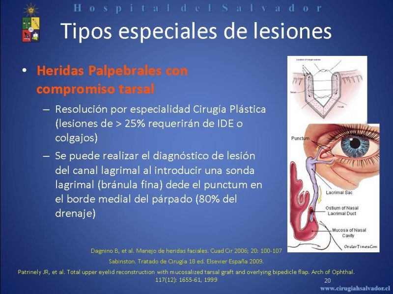 Diapositiva 19 de Evaluación y manejo de lesiones faciales