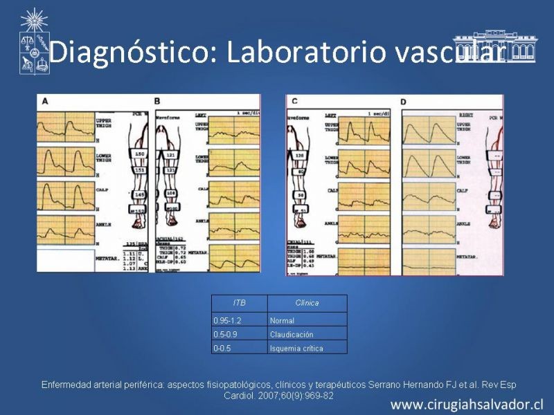 Diapositiva 5 de Tratamiento endovascular de la EAO infrainguinal