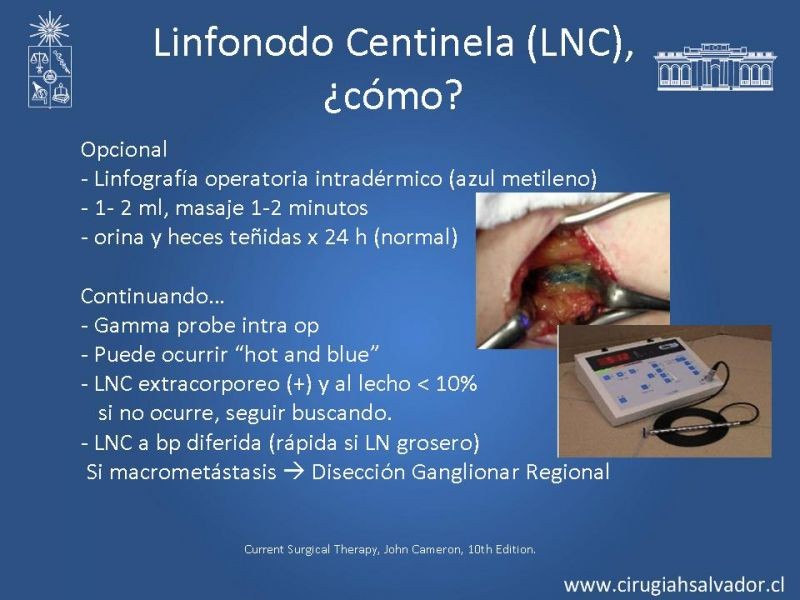 Diapositiva 22 de Manejo Quirúrgico de Melanoma