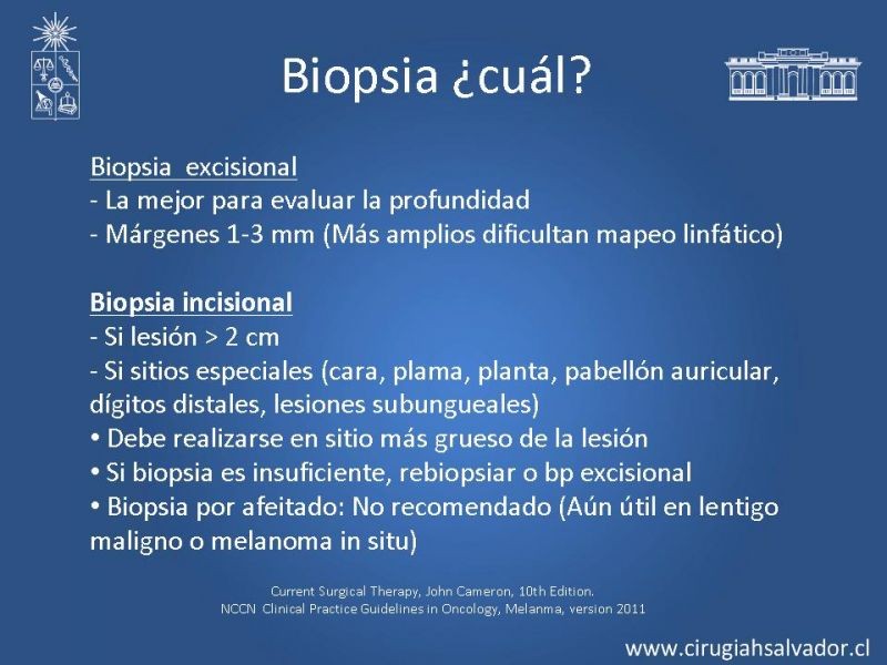 Diapositiva 7 de Manejo Quirúrgico de Melanoma