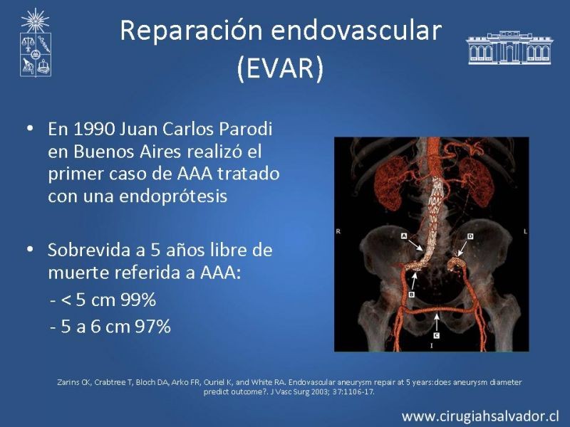 Diapositiva 3 de Resultados en el manejo de AAA infrarrenal (EVAR) 