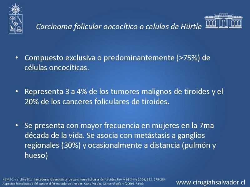 Diapositiva 19 de Cáncer de tiroides no papilar