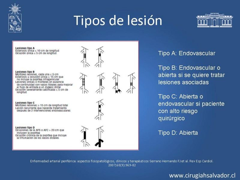 Diapositiva 12 de Tratamiento endovascular de la EAO infrainguinal