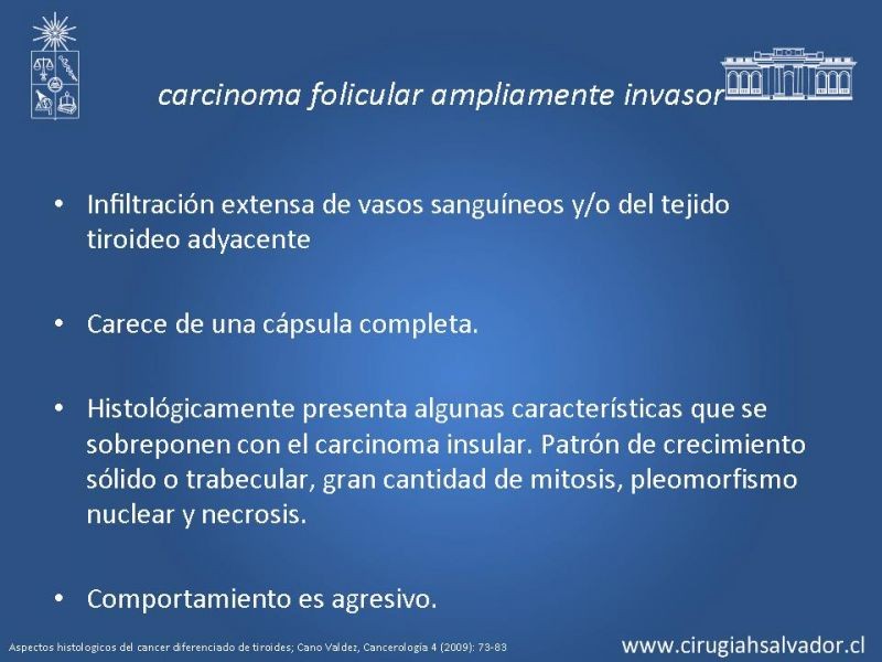Diapositiva 17 de Cáncer de tiroides no papilar