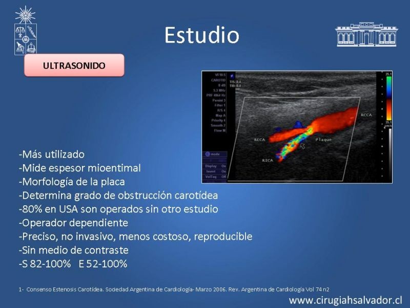 Diapositiva 8 de Estenosis Carotídea