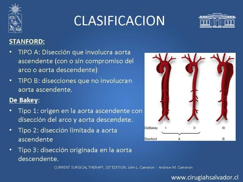 Diapositiva 5 de Disección aórtica tipo B manejo actual