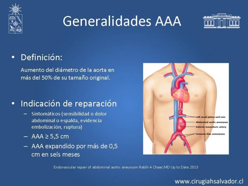 Diapositiva 1 de Resultados en el manejo de AAA infrarrenal (EVAR) 