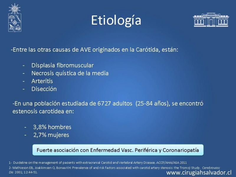 Diapositiva 3 de Estenosis Carotídea