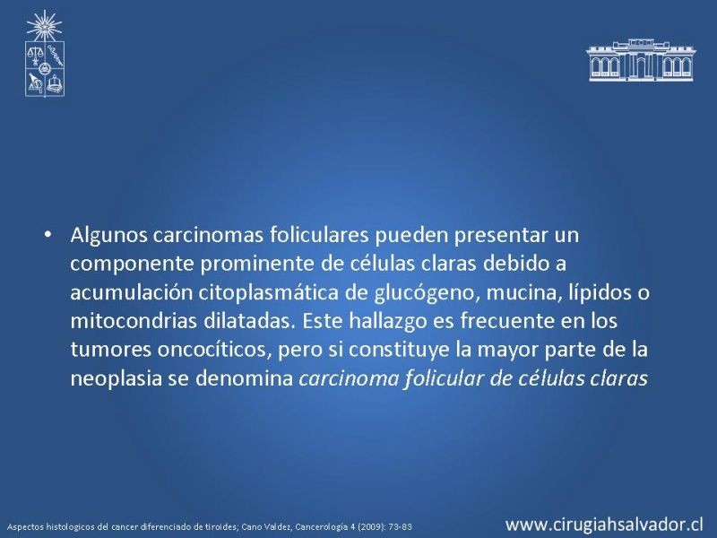 Diapositiva 20 de Cáncer de tiroides no papilar