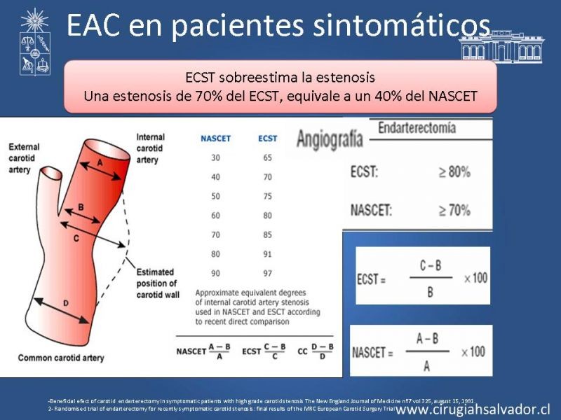 Diapositiva 21 de Manejo de pacientes con Enfermedad Carotídea Extracraneal Asintomáticos