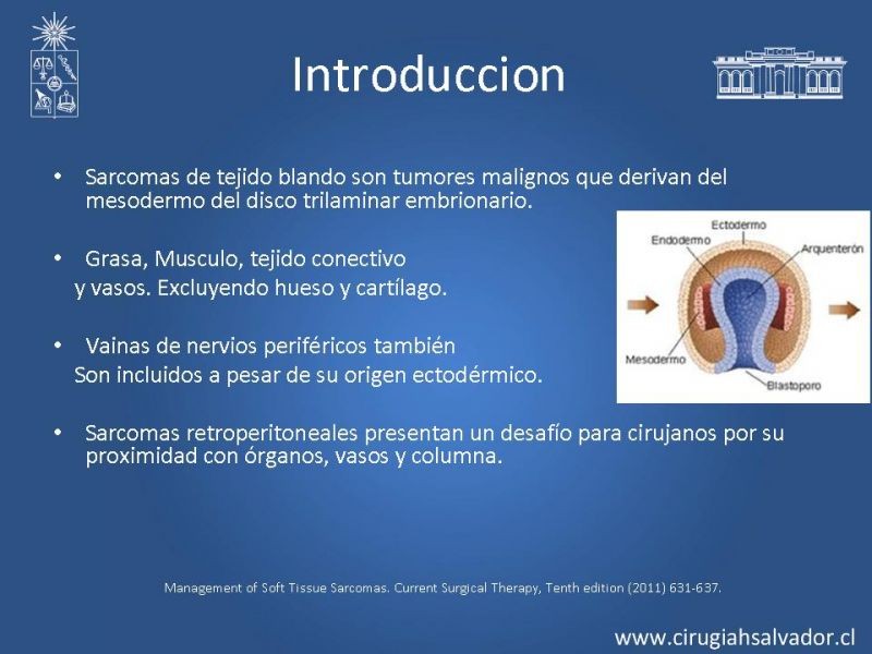 Diapositiva 1 de Sarcoma retroperitoneal