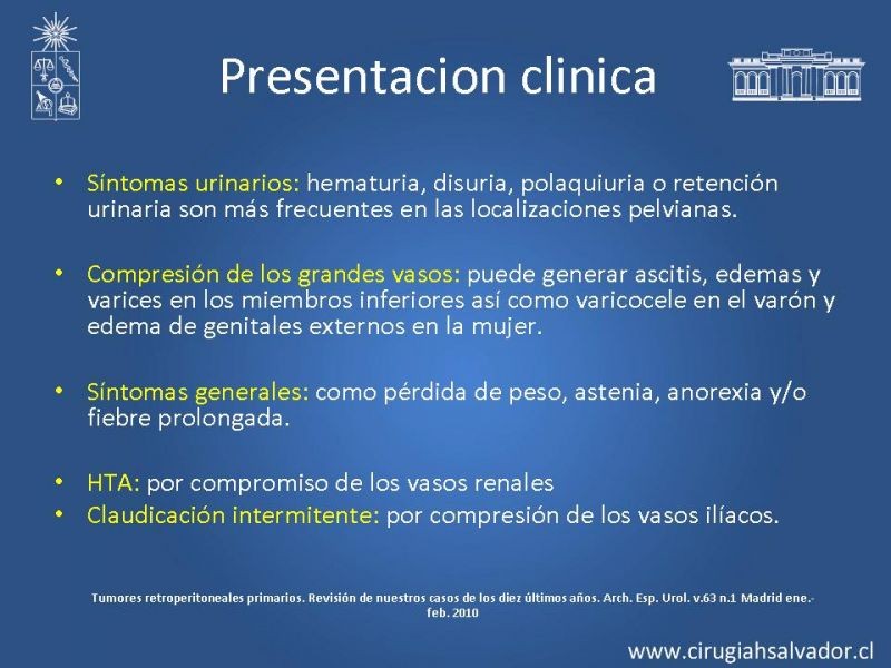 Diapositiva 7 de Sarcoma retroperitoneal