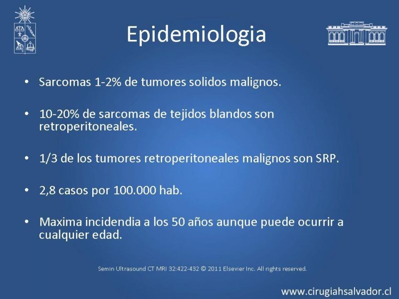 Diapositiva 3 de Sarcoma retroperitoneal