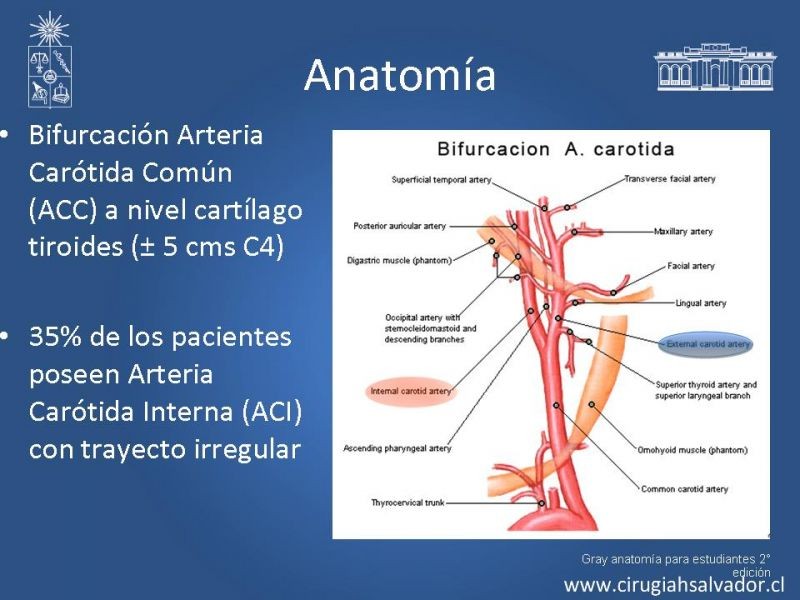 Diapositiva 4 de Manejo de pacientes con Enfermedad Carotídea Extracraneal Asintomáticos