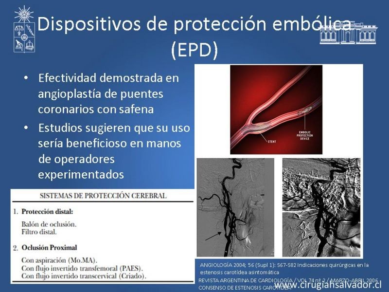 Diapositiva 63 de Manejo de pacientes con Enfermedad Carotídea Extracraneal Asintomáticos