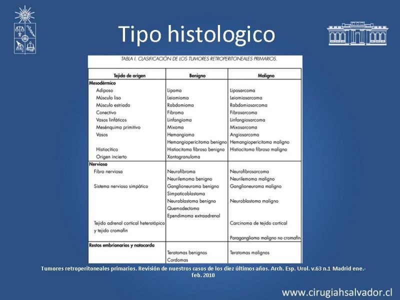 Diapositiva 8 de Sarcoma retroperitoneal