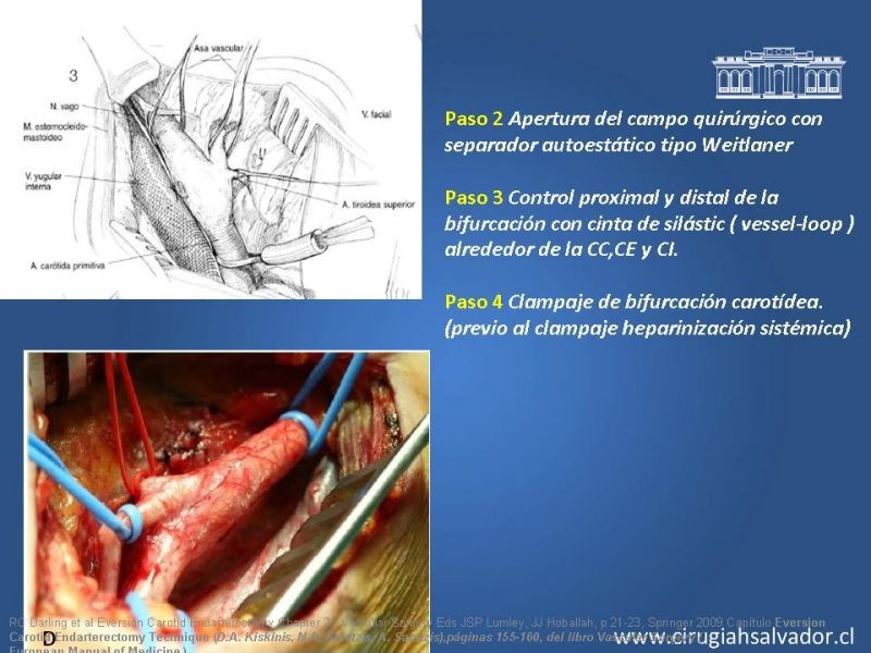 Diapositiva 37 de Manejo de pacientes con Enfermedad Carotídea Extracraneal Asintomáticos