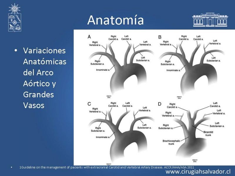Diapositiva 1 de Manejo de pacientes con Enfermedad Carotídea Extracraneal Asintomáticos