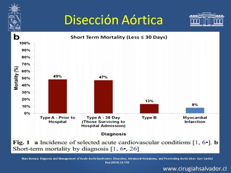 Diapositiva 15 de Sindrome Aórtico Agudo (SAA)