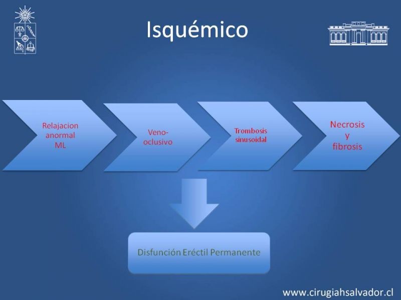 Diapositiva 6 de Priapismo